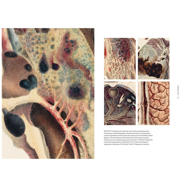 Book - The Sick Rose - Disease and the Art of Medical Illustration